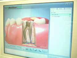 説明用モニターの写真です