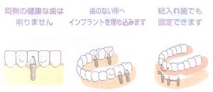 �C���v�����g���Â̎ʐ^�ł��B